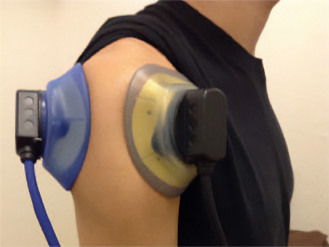 ３Ｄ療法（立体動態波）／実際の使用例