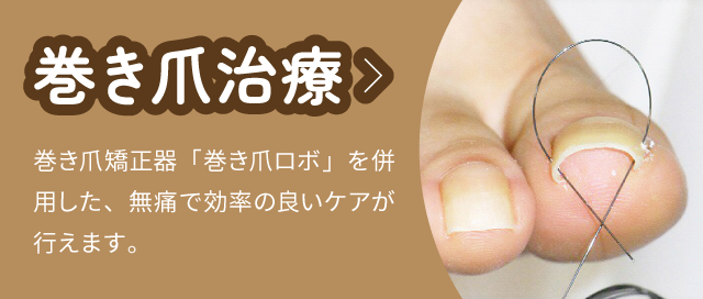 巻き爪治療:巻き爪矯正器「巻き爪ロボ」を併用した、無痛で効率の良いケアが行えます。