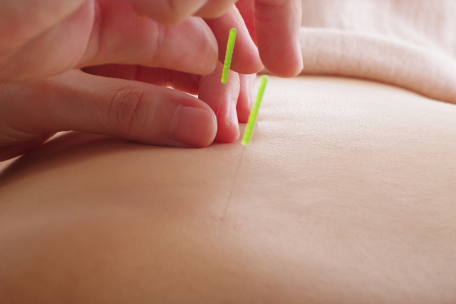 はり・きゅう外来