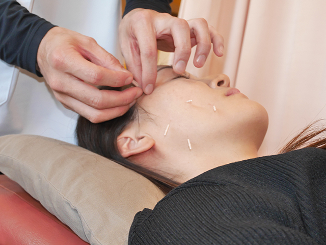 美容はりプラン02